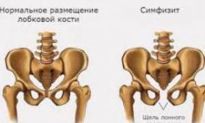 Упътвания: от метростанция Obolon - трол.