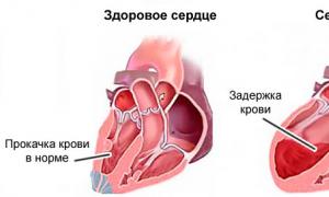 दिल की विफलता के साथ सांस की तकलीफ सांस की तकलीफ के लिए प्राथमिक उपचार प्रदान करना