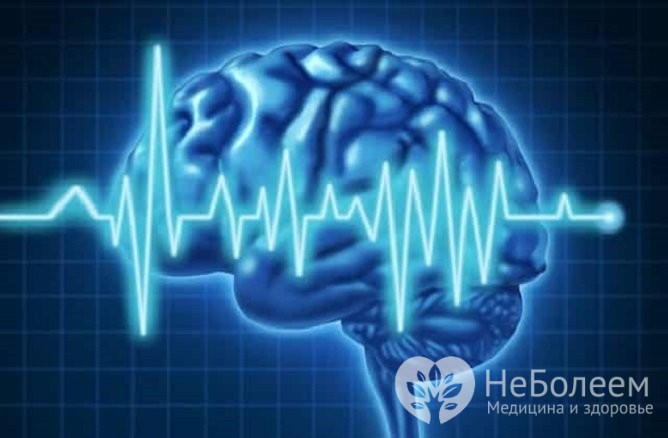 Какво представлява абсцесната епилепсия и нейните симптоми