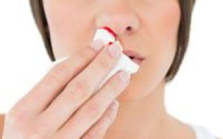 Prečo snívate o krvácaní z nosa: na sebe alebo na iných?