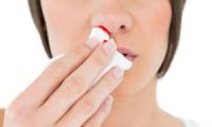 Why do you dream about nosebleeds: on yourself or others?