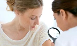 Dermatovenerológ: čo lieči