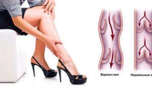 Изгаряне в крака под коляното: причини за патология