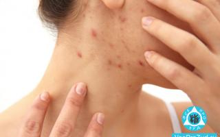 The skin on the face turns red, flakes and itches: causes and treatment of itching
