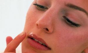 Hitro lajšanje herpesa na ustnicah