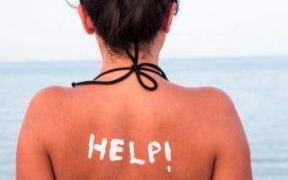 Sunburn: symptoms, dangers and consequences