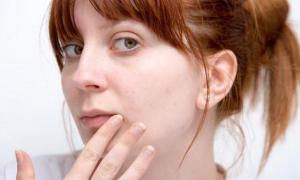 होठों पर दाद का कारण क्या है: कारण, रोकथाम, उपचार की विशेषताएं
